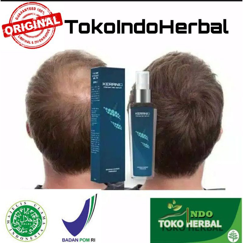 KERANIQ Hair Serum Penumbuh Penyubur Rambut Original