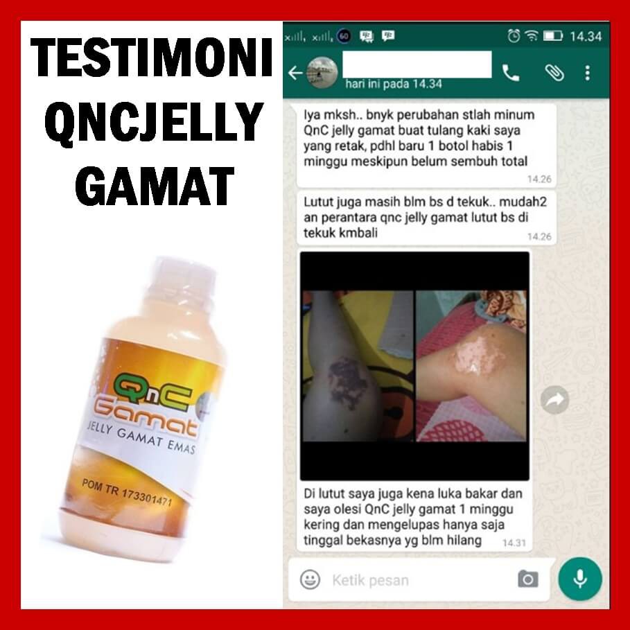 Obat Mata Juling Qnc Jelly Gamat Bergaransi Legalitas Bpom Mata Jereng Indonesia