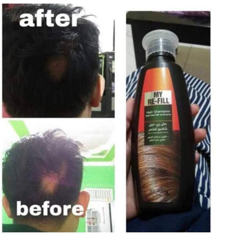 CL_ Sampo Anti Rontok My Way My Refill & Nature's Shampoo-1