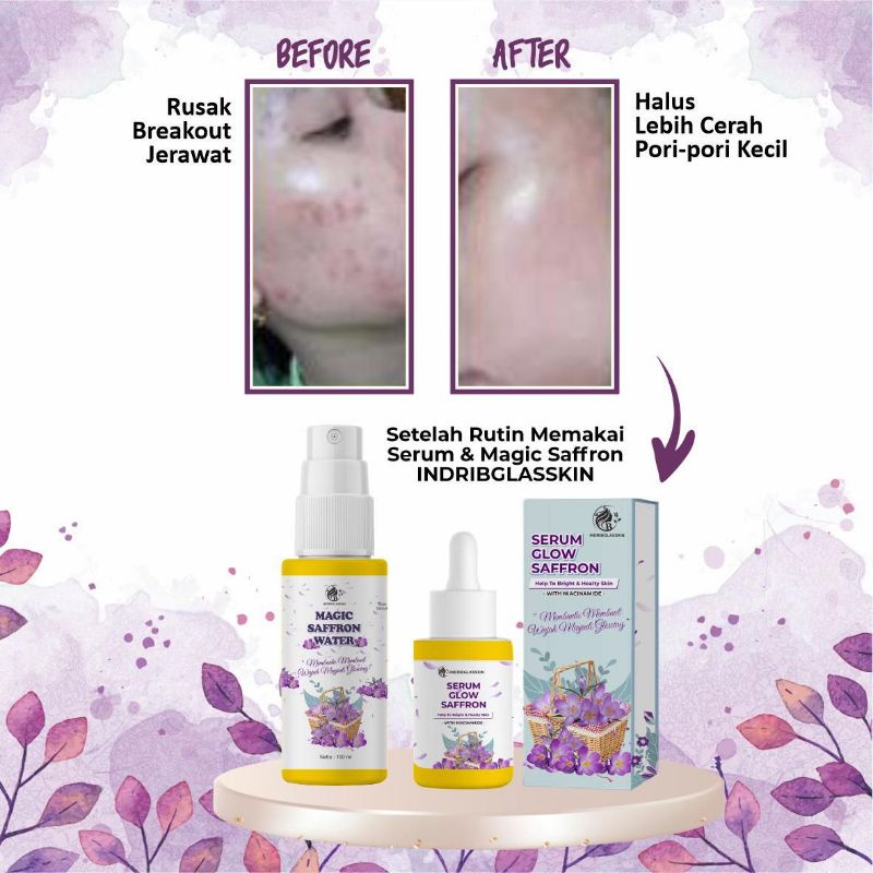 [BELI 1 FREE GIFT/HADIAH] IBGLASSKIN GLOW SERUM BPOM