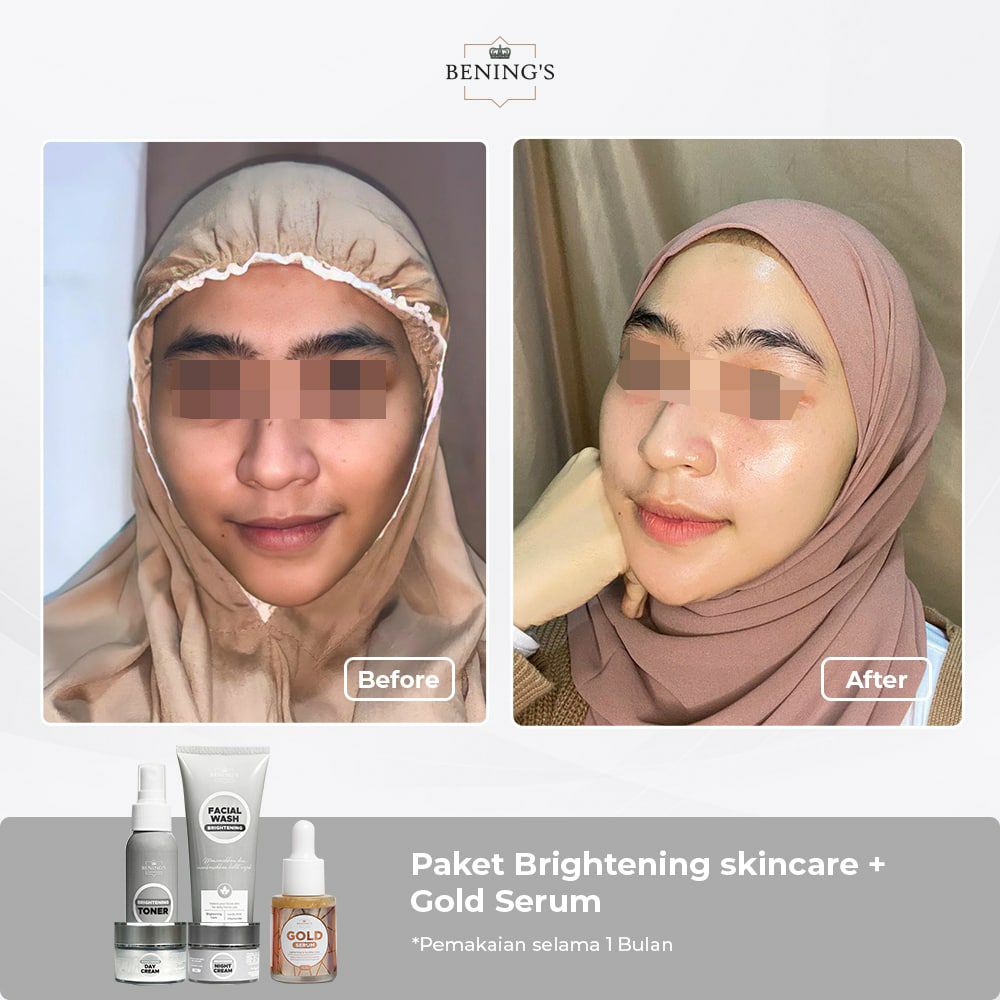 BENINGS SKINCARE BY DR.OKY PRATAMA PAKET BRIGHTENING (BENINGS CLINIC) BENING PAKET PENCERAH DAN GLOWING