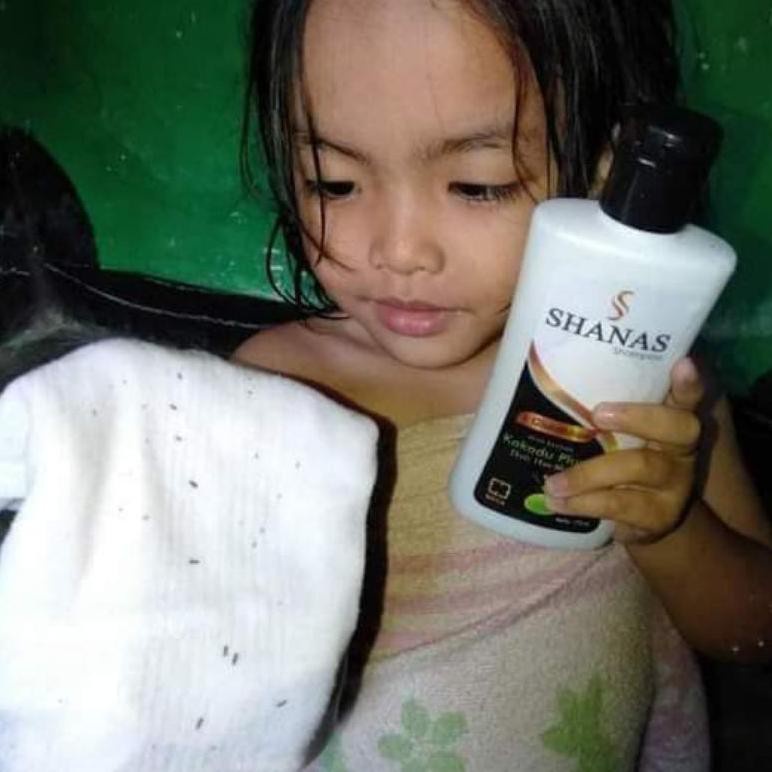 (COD) SHAMPO SHANAS - SHAMPO KUTU RAMBUT - SHAMPO KETOMBE - SHANAS SHAMPO KUTU