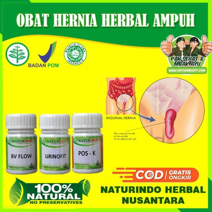 

BISA COD OBAT HERNIA PALING AMPUH HERBAL TURUN BEROK HERNIA DEWASA ANAK BPOM /OBAT HERBAL ASAM URAT/OBAT HERBAL PELANGSING/OBAT HERBAL KOLESTEROL/OBAT HERBAL DIABETES