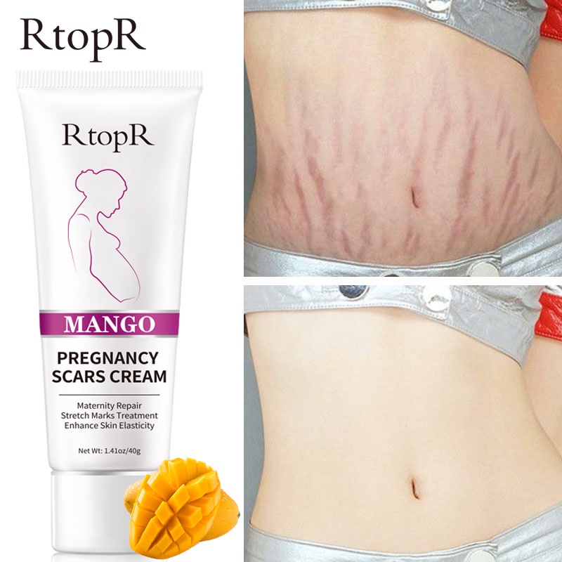 [Ori100%]RtopR Mango Pregnancy Scars Cream Maternity Repair Firming Enhance Skin Elasticity Stretch Marks Treatment Tubuh Postpartum Stretch Mark Perbaikan Krim Anti-Aging Kulit 40g