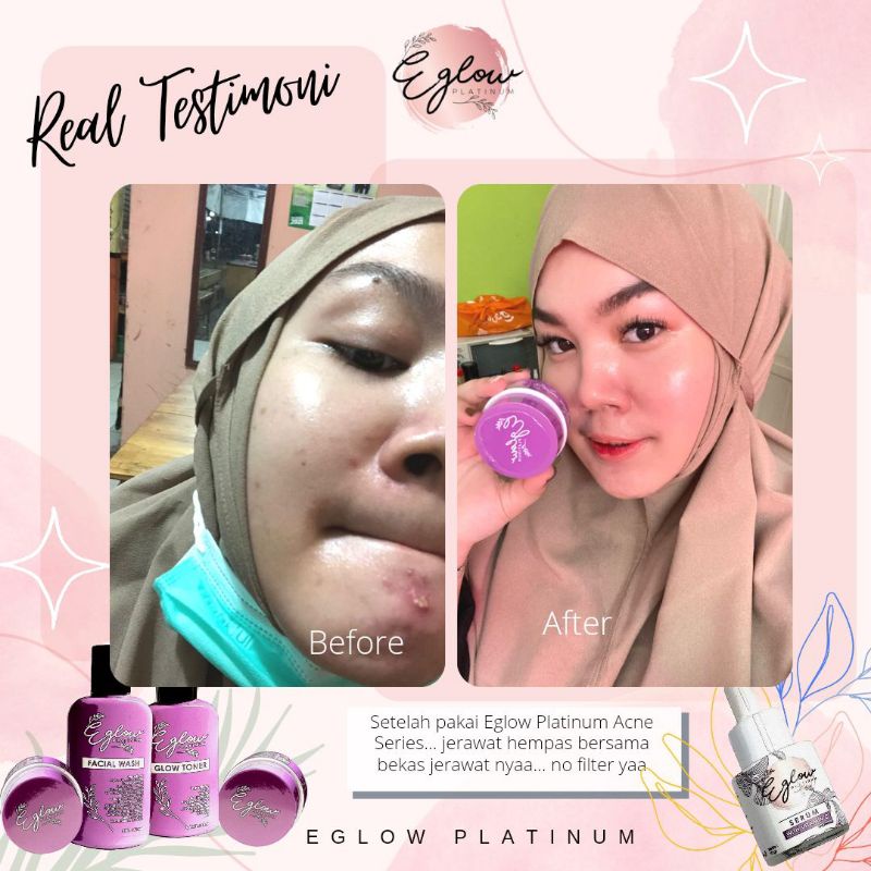 EGLOW PLATINUM BPOM  EGLOW WHITENING SERIES EGLOW SKINCARE