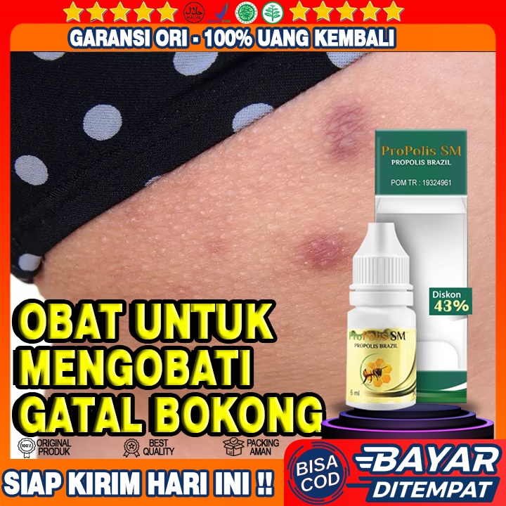 Obat Herbal Gatal Gatal Di Bokong, Selangkangan Hitam, Eksim, Panuan, Pantat Lecet Berkerak