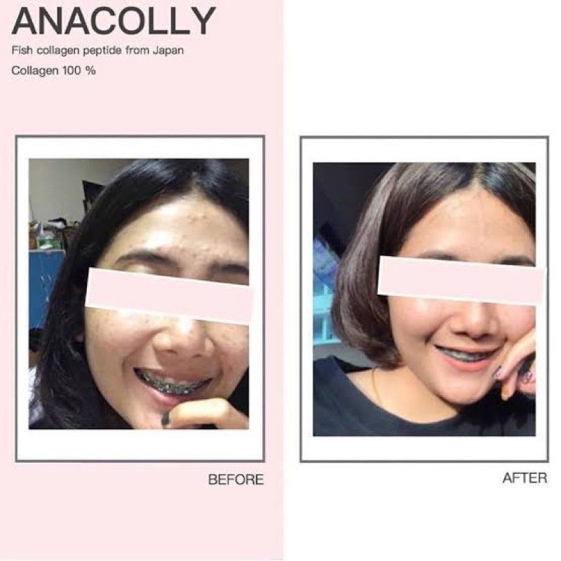 [READY] ANA COLLY COLLAGEN 100% ORIGINAL THAILAND/ ANA COLLY FULL ISI 60 KAPSUL &amp; SHARE IN JAR 15 KAPSUL &amp; 30 KAPSUL /SHARE IN JAR ANA COLLY