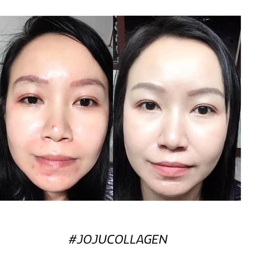 Akhir Bulan✔️JOJU COLLAGEN DRINK BY AIMI [BPOM]|KD8