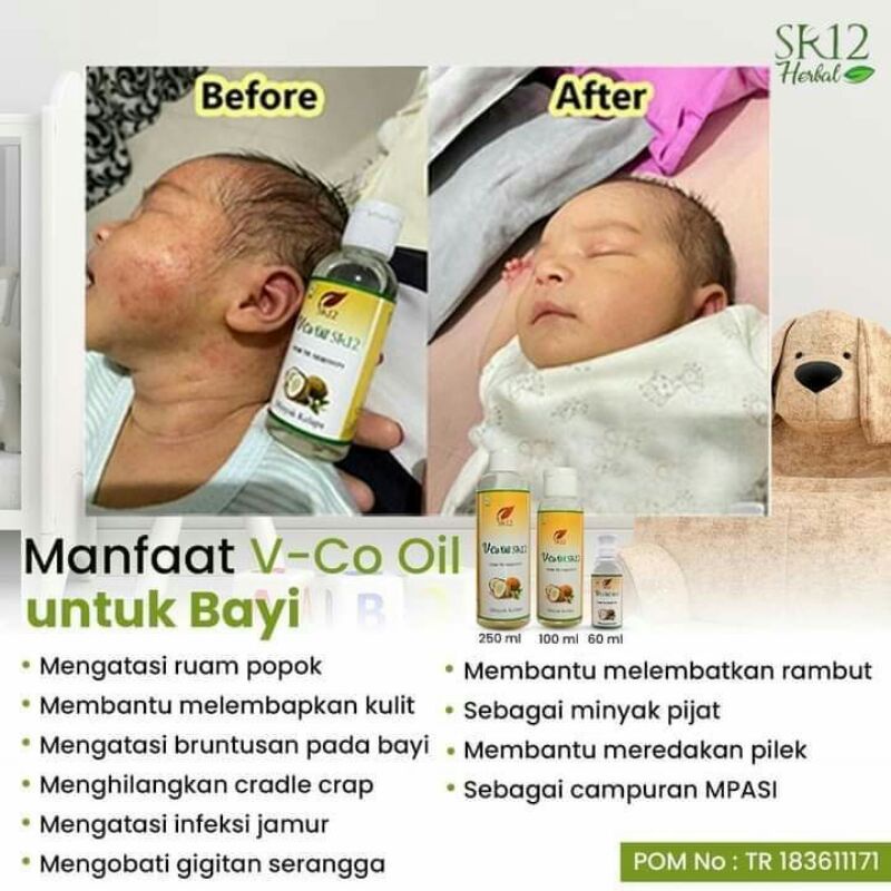 Obat ampuh untuk Ruam popok bayi ,Ruam pipi , leher merah pada bayi ,biang keringat bayi 100ml herba