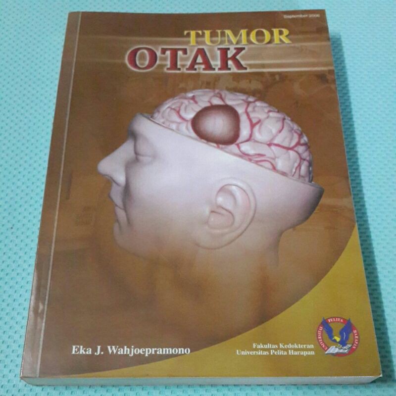 TUMOR OTAK