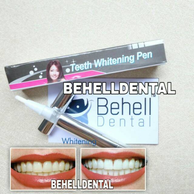 Pemutih gigi pen . Teeth whitening pen . Bleaching tooth . Penghilang karang gigi ampuh . cairan gel