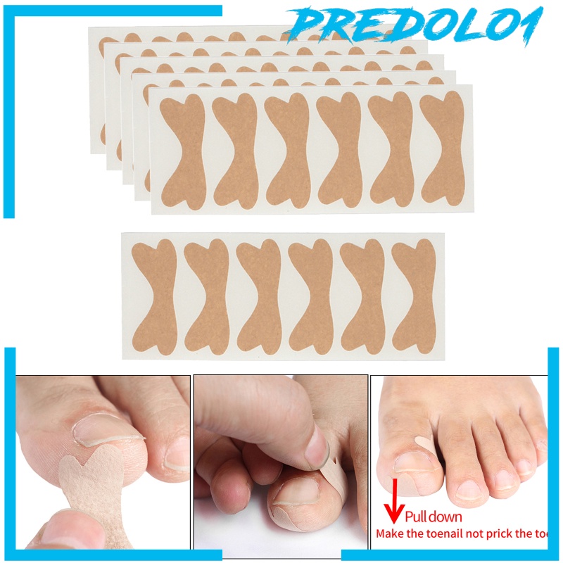 [PREDOLO1]Ingrown Toenail Stickers Elastic Glue Free Painless Nail Correction Foot nail Patches for Women Men