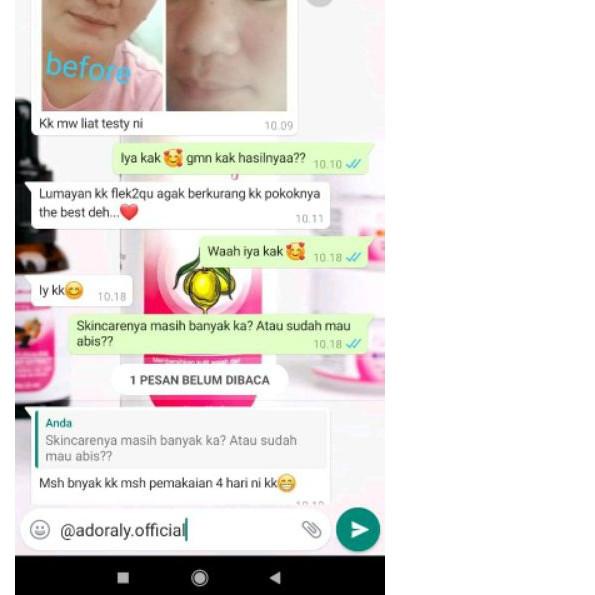 Adoraly skincare Original skincare paling glow adoraly skincare jakarta adoraly jakarta asli adorali
