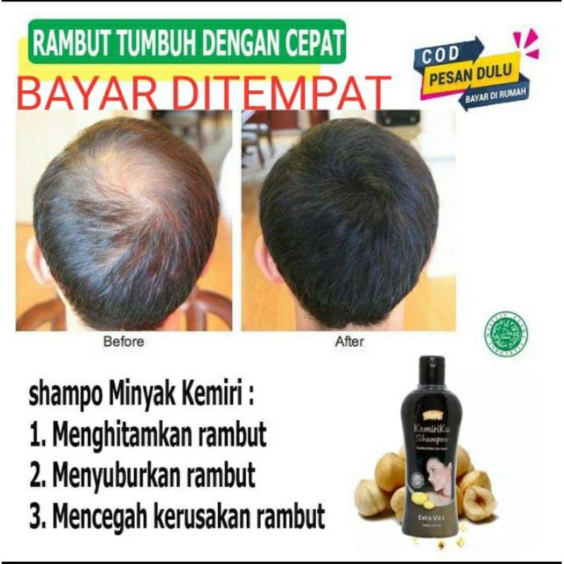 Happy Kemiriku SHAMPOO ( HITAM )