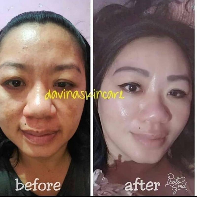 Daviena Skincare Gold Series