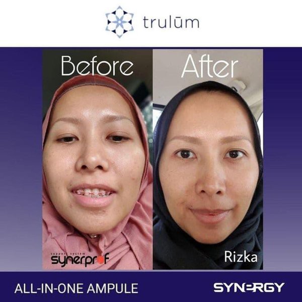 Krim Penghilang Kerutan Di Wajah dan dibawah Mata Obat Penghilang Jerawat Flek hitam Paling Ampuh