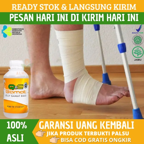 Obat Patah Tulang, Obat Tulang Patah, Obat Patah Tulang Kaki, Obat Patah Tulang Tangan, Obat Patah T