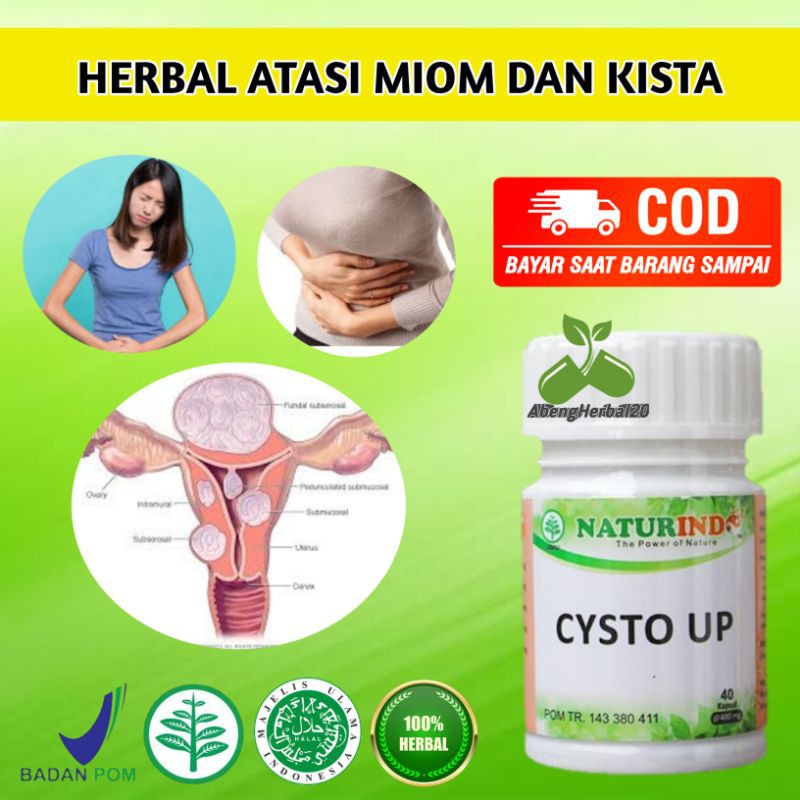 CYSTO UP obat herbal Kista dan miom dengan gejala mudah lelah nyeri bab beser perut kembung-1