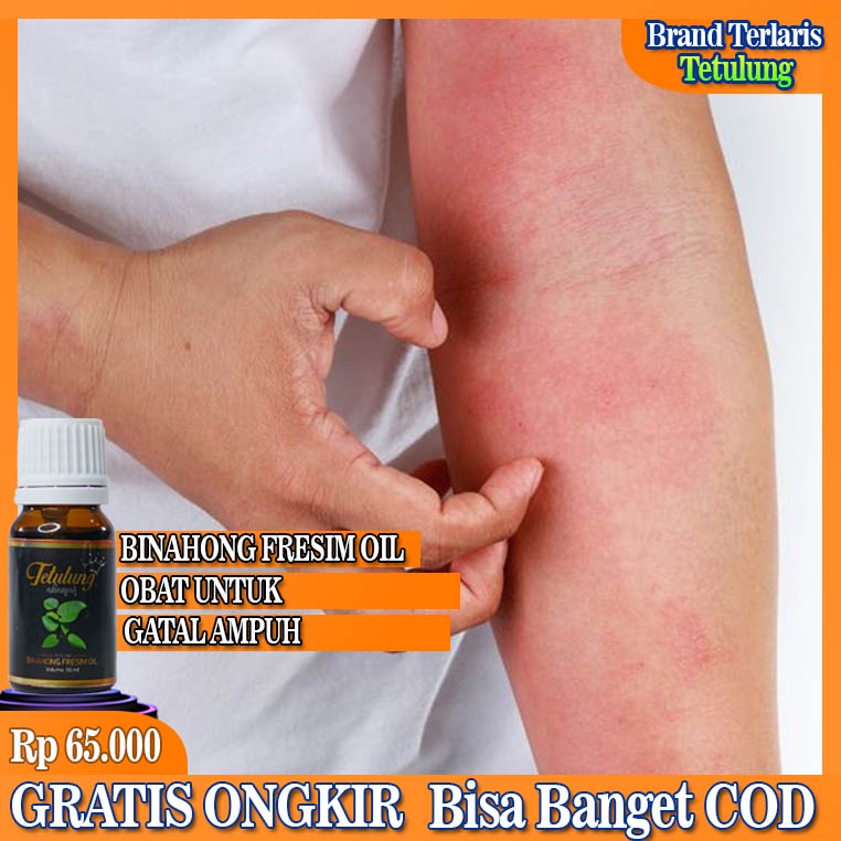 Fresim Oil Tetulung Binahong, Salep Gatal Ampuh, Obat Gatal Kudis Kurap Panu Kutu Air Ampuh, Obat Be