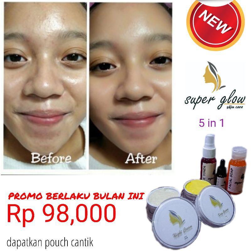 Jual paket cream whitening glowing standar BPOM - SUPER GLOW LENGKAP 5