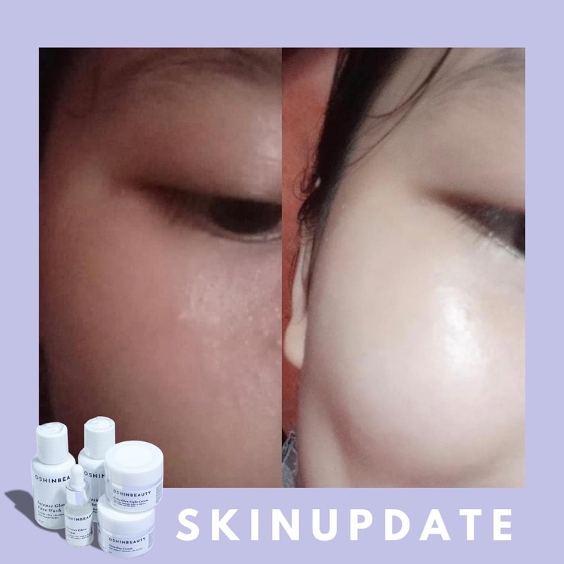 (OSHINBEAUTY) Paket Skincare Glow dan Acne Series Complete BPOM [Free Gift/Bonus]-3
