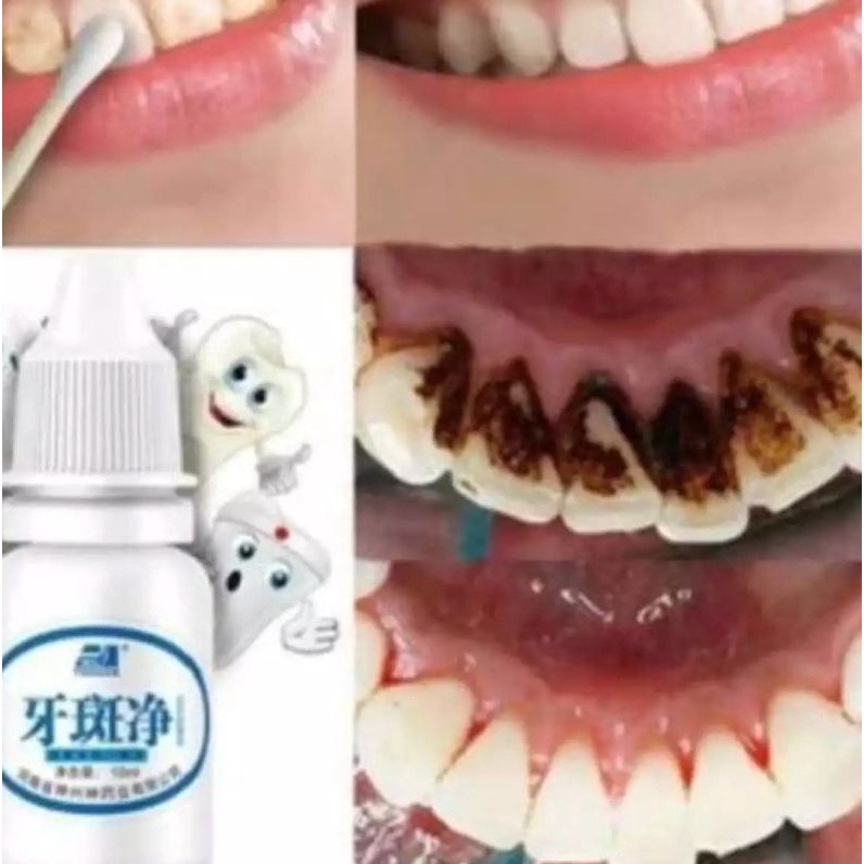 PEMUTIH GIGI PENGHILANG PLAK KARANG GIGI YABANJING TEETH WHITENING ORIGINAL DIJAMIN