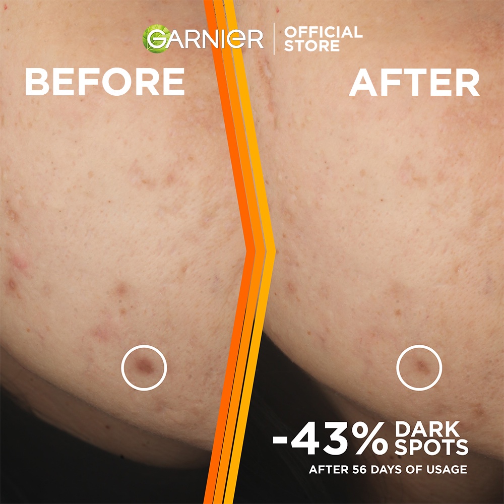 Garnier Bright Complete Vitamin C 30x Booster Serum 30ml Skincare - Cepat Cerahkan Noda Hitam dan Samarkan Bekas Jerawat