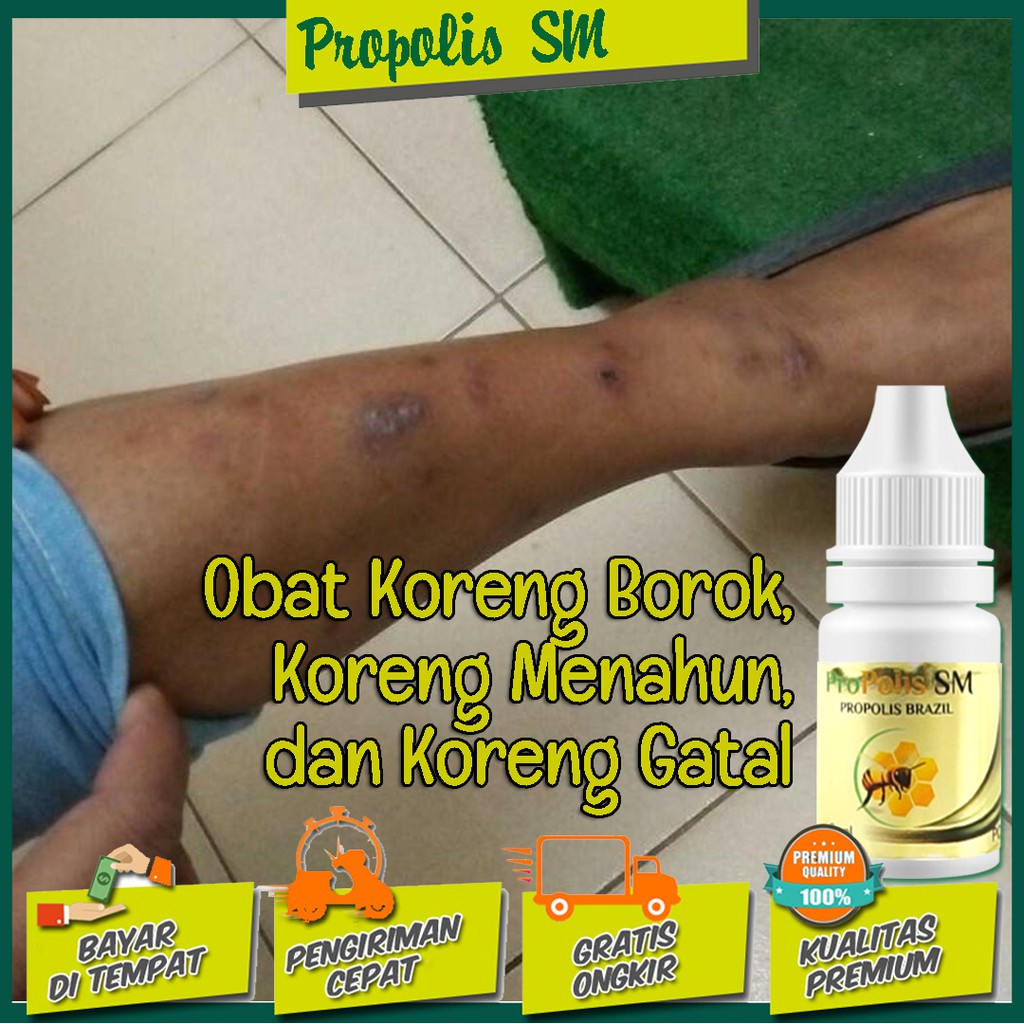 Obat Koreng Borok, Koreng Menahun, dan Koreng Gatal Alami PROPOLIS