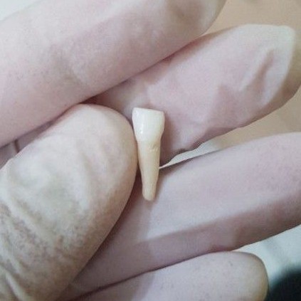 [SULUNG/SUSU] GIGI ASLI MANUSIA SERI / INCISIVUS SUSU / SULUNG / ANAK UNTUK PRAKTIKUM