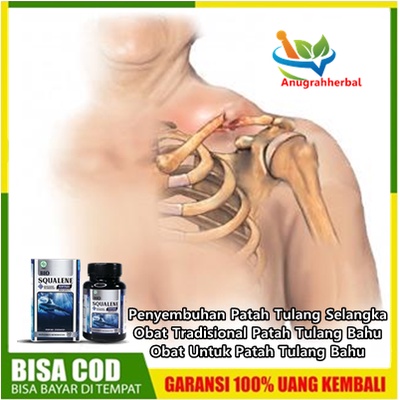 Penyembuhan Patah Tulang Selangka, Obat Tradisional Patah Tulang Bahu, Obat Untuk Patah Tulang Bahu,