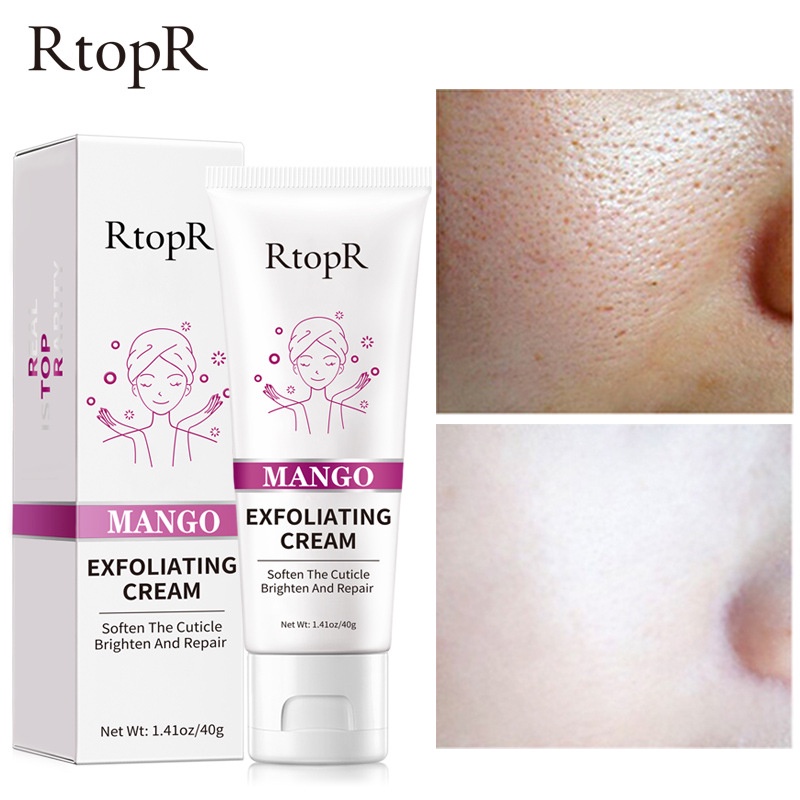 RtopR MANGO Exfoliating Cream Skin Care Whitening Moisturizer Repair Facial Scrub Skin Cleaner Acne Blackhead Treatment Remove Face gel(40g)