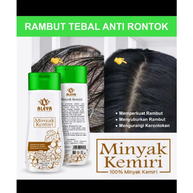 Kemiri Aleya Penyubur Rambut Pelembut Nana Pelurus Rambut Vitamin Rambut Hair Treatment Obat Ketombe