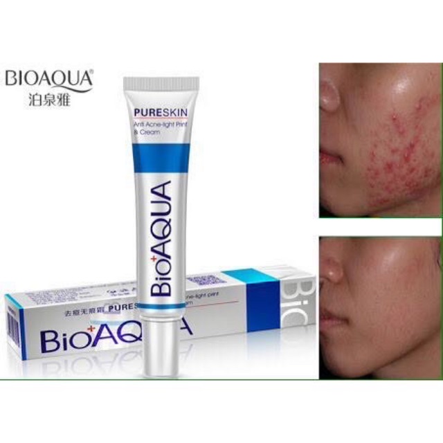 Qq88 30gr Tube Bioaqua Pure Skin Acne Rejuvenation Cream Removal Of Acne Cream Jerawat Shopee Indonesia