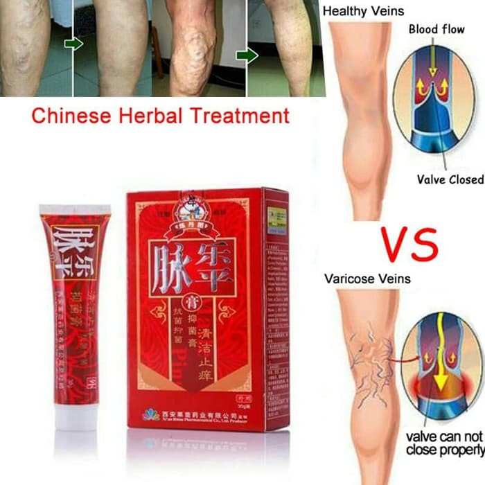 " CREAM PENGOBATAN VARISES ORIGINAL VARICOSE