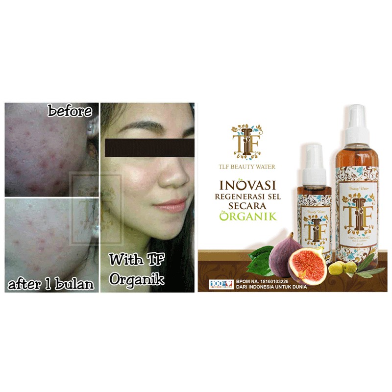 Obat Jerawat Ampuh Cepat Kering | Cleanser Toner - DKMALL TLF Beauty Water 100ml