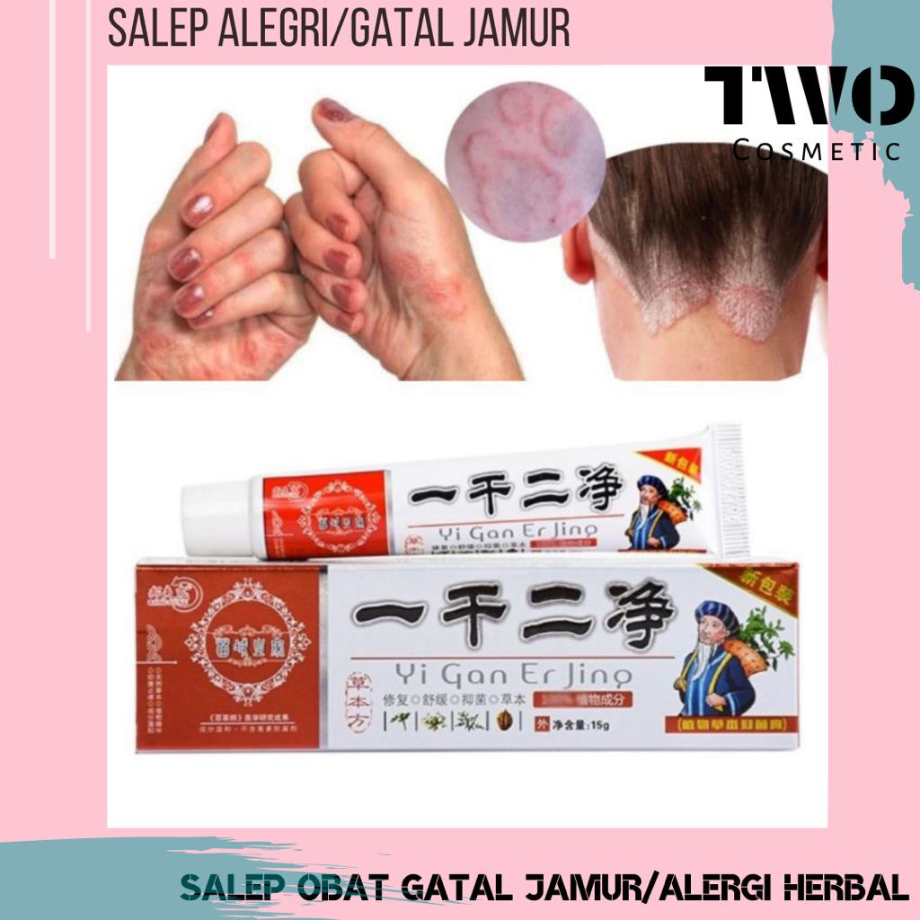 Salep Gatal Yi Gan Er Jing Salep panu, salep ezcema