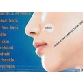 ❉ DERMAROLLER 0.5 mm DERMA ROLLER MICRO 540 NEEDLES ROLLER SKIN - 0.5mm ☋