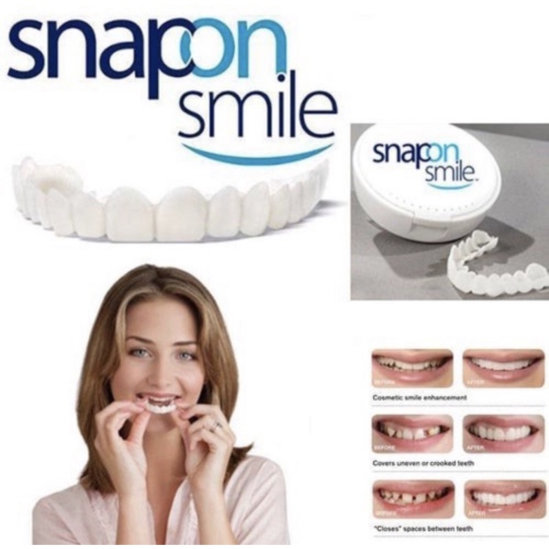 ORIGINAL Snap On Smile Veneer Gigi Palsu Set Atas Bawah