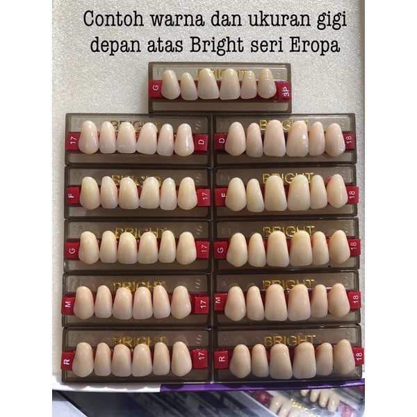 Eceran gigi palsu depan/ Anterior denture Eropa