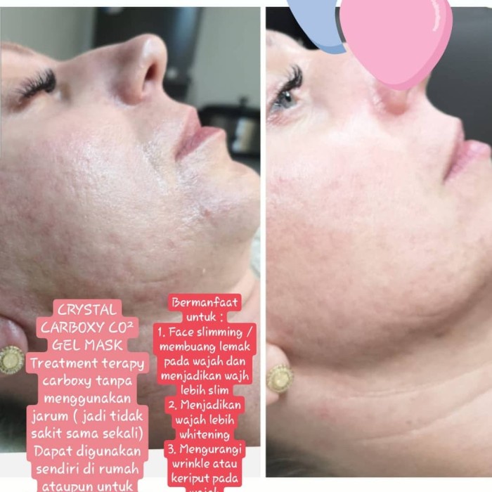 CRYSTAL CARBOXY CO² GEL MASK gel untuk mengencangkan wajah