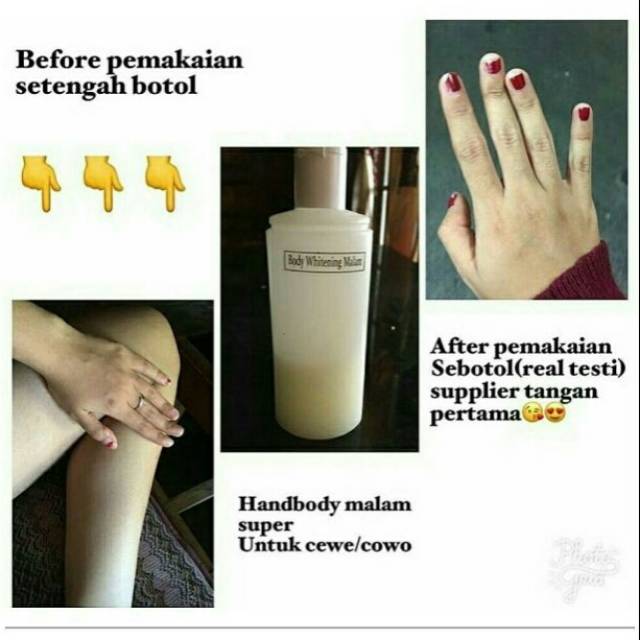 HB Anggur dosting original