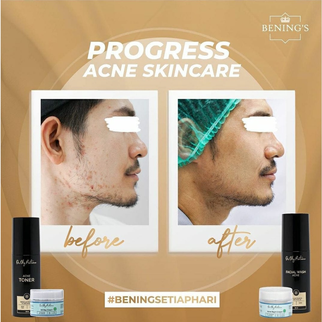 Bening's Promo Acne Skincare (okyslim trial) | Paketan Jerawat dan Beruntusan-6