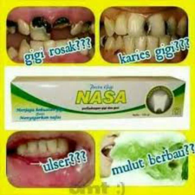 #pasta gigi nasa/pasta gigi herbal/pasta gigi semua jenis kulit/pasta gigi herbal