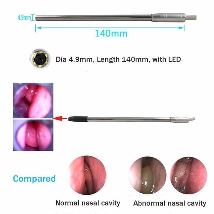 Alat Medis Endoskopi THT   HD Camera   Lensa 4 9mm u  HP Android   PC