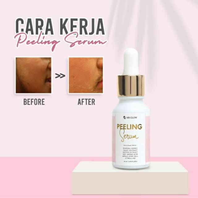 Msglow Serum Peeling - 1 item