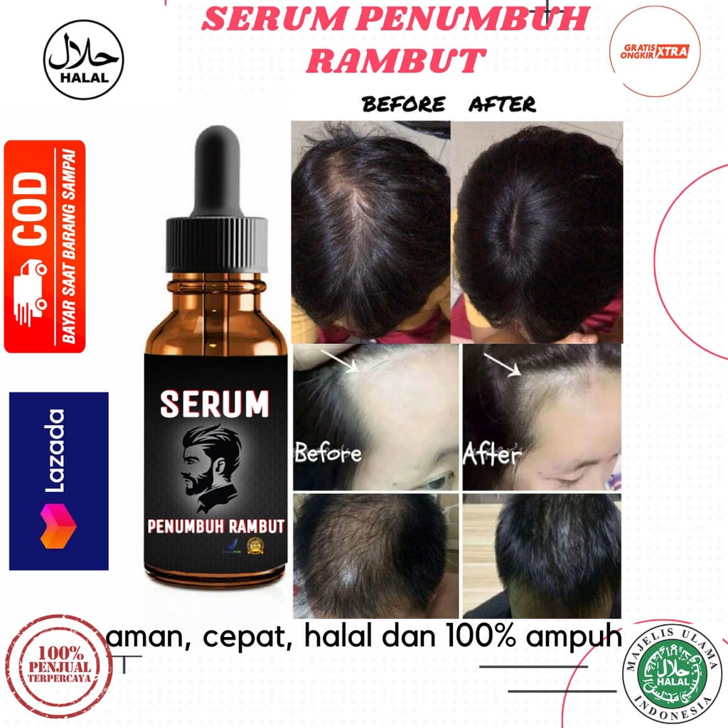 serum penumbuh rambut/serum penumbuh rambut botak/serum penumbuh rambut botak super cepat/serum penumbuh rambut botak super cepat/sewrum penumbuh rambut rontok/serum penumbuh rambut wanita/serum penumbuh rambut bayi/serum penumbuh rambut anak