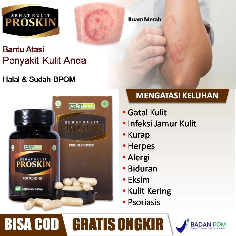 Jual Obat Kulit Gatal, Infeksi Jamur, Kurap, Ruam Merah, Herpes, Bintik ...