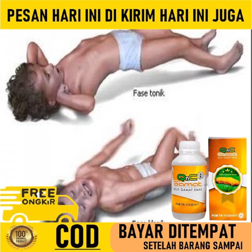 Obat epilepsi anak, Obat Epilepsi ayan, Obat sakalor kejang dewasa, Obat kejang pada bayi, Obat epil