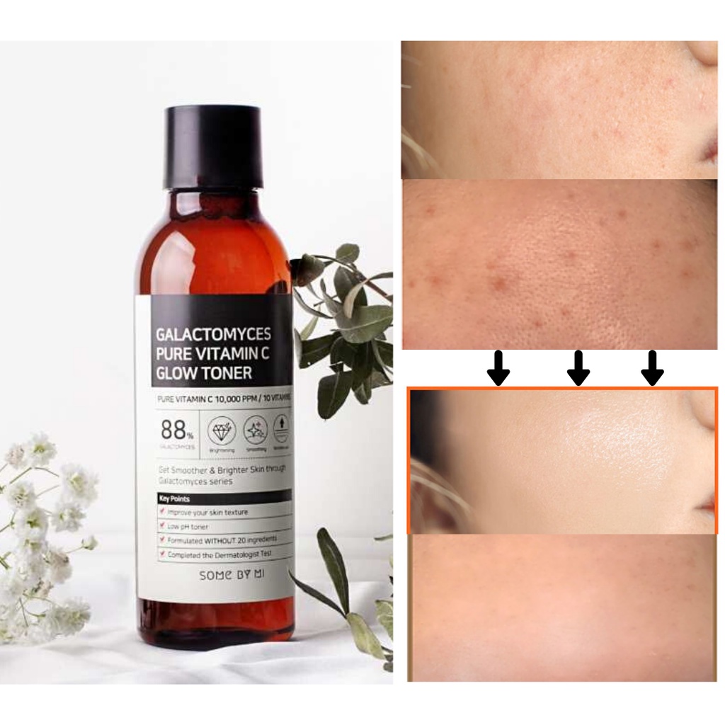 SOME BY MI Galactomyces Pure Vitamin C - Brightening Face Toner Serum