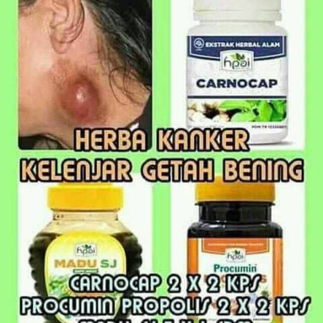 

HNI PAI halalan thoyiban